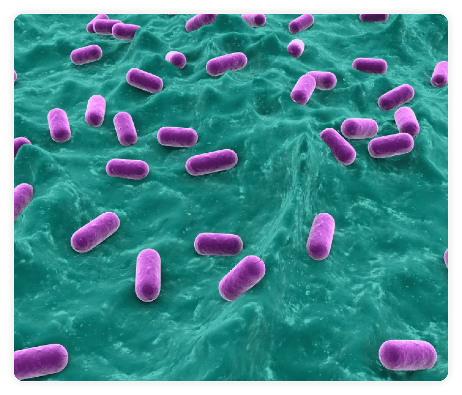 Pediococcus_Acidilactici