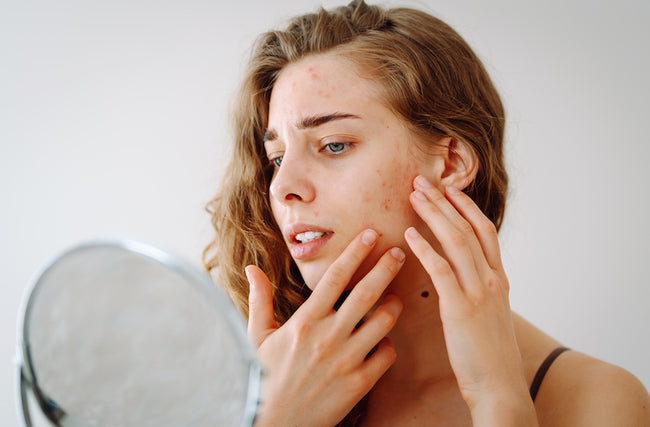 Is Leaky Gut Causing Your Skin Issues?